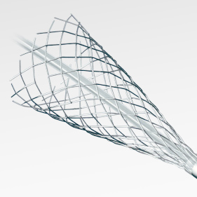 頸動脈拡張用ステント